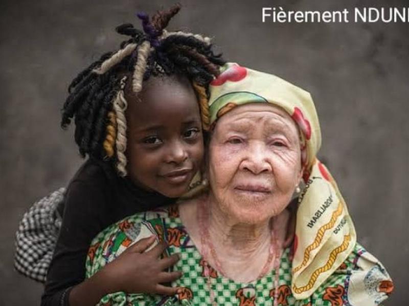 Une albinos avec sa petite fille